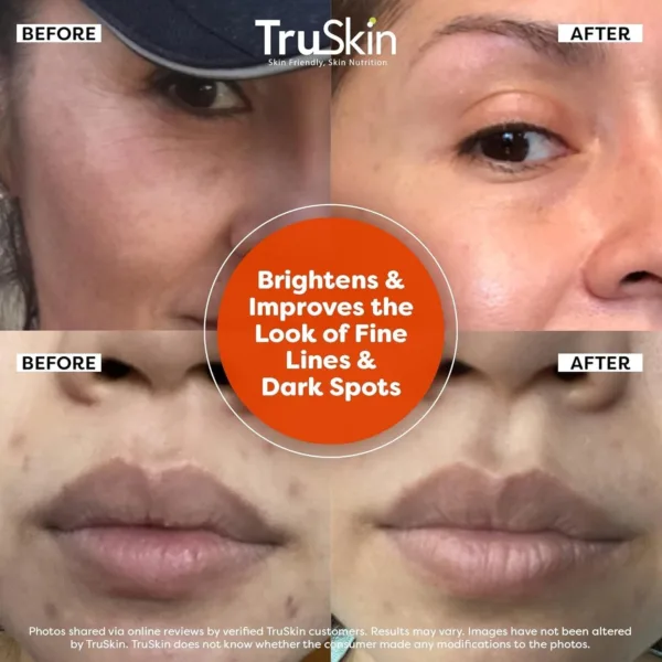 TruSkin Vitamin C Serum For Face - Image 4